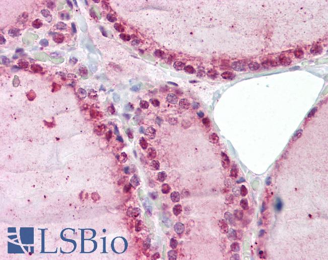 Anti-ZNF346 antibody IHC of human thyroid. Immunohistochemistry of formalin-fixed, paraffin-embedded tissue after heat-induced antigen retrieval. Antibody LS-B7038 concentration 5 ug/ml.