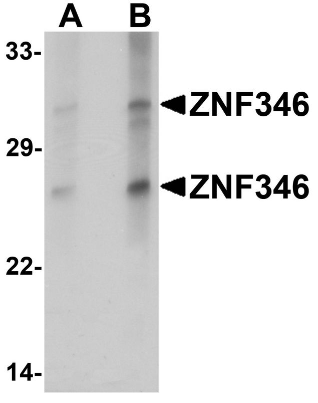 Western blot analysis of ZNF346 in human kidney tissue lysate with ZNF346 antibody at (A) 1 and (B) 2 ug/ml.