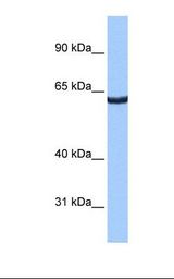 HepG2 cell lysate. Antibody concentration: 0.5 ug/ml. Gel concentration: 8%.
