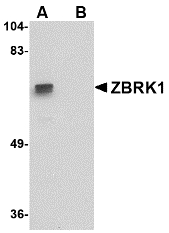 Western blot of ZBRK1 in A-20 lysate with ZBRK1 antibody at 1 ug/ml in (A) the absence and (B) the presence of blocking peptide.