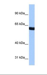 Fetal brain cell lysate. Antibody concentration: 0.5 ug/ml. Gel concentration: 8%.