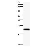 Western blot analysis of immunized recombinant protein, using anti-ZNF354A monoclonal antibody.
