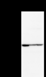 Detection of ZNF354A by Western blot. Samples: Whole cell lysate from human HeLa (H, 25 ug) , mouse NIH3T3 (M, 25 ug) and rat F2408 (R, 25 ug) cells. Predicted molecular weight: 69 kDa