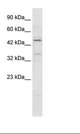 Jurkat Cell Lysate