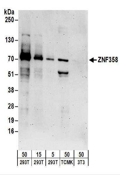 Detection of Human and Mouse ZNF358 by Western Blot. Samples: Whole cell lysate from 293T (5, 15 and 50 ug), mouse TCMK-1 (50 ug), and mouse NIH3T3 (50 ug) cells. Antibodies: Affinity purified rabbit anti-ZNF358 antibody used for WB at 0.1 ug/ml. Detection: Chemiluminescence with an exposure time of 3 minutes.