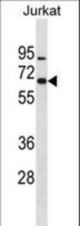 ZNF358 Antibody western blot of Jurkat cell line lysates (35 ug/lane). The ZNF358 antibody detected the ZNF358 protein (arrow).