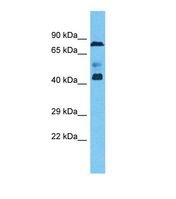 Western blot of Human Ovary Tumor. ZNF362 antibody dilution 1.0 ug/ml.