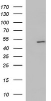 HEK293T cells were transfected with the pCMV6-ENTRY control (Left lane) or pCMV6-ENTRY ZNF365 (Right lane) cDNA for 48 hrs and lysed. Equivalent amounts of cell lysates (5 ug per lane) were separated by SDS-PAGE and immunoblotted with anti-ZNF365.