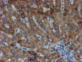 IHC of paraffin-embedded Human liver tissue using anti-ZNF365 mouse monoclonal antibody. (Heat-induced epitope retrieval by 10mM citric buffer, pH6.0, 100C for 10min).