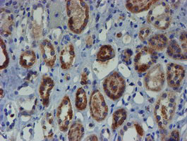 IHC of paraffin-embedded Human Kidney tissue using anti-ZNF365 mouse monoclonal antibody. (Heat-induced epitope retrieval by 10mM citric buffer, pH6.0, 100C for 10min).