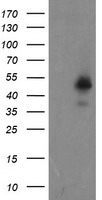 HEK293T cells were transfected with the pCMV6-ENTRY control (Left lane) or pCMV6-ENTRY ZNF365 (Right lane) cDNA for 48 hrs and lysed. Equivalent amounts of cell lysates (5 ug per lane) were separated by SDS-PAGE and immunoblotted with anti-ZNF365.