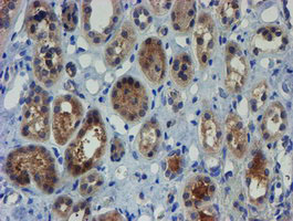 IHC of paraffin-embedded Human Kidney tissue using anti-ZNF365 mouse monoclonal antibody.