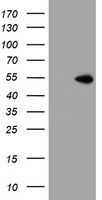 HEK293T cells were transfected with the pCMV6-ENTRY control (Left lane) or pCMV6-ENTRY ZNF365 (Right lane) cDNA for 48 hrs and lysed. Equivalent amounts of cell lysates (5 ug per lane) were separated by SDS-PAGE and immunoblotted with anti-ZNF365.