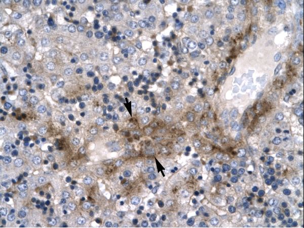 ZNF365 antibody LS-C29710 was used in IHC to stain formalin-fixed, paraffin-embedded human liver.