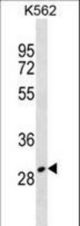 ZNF365 Antibody western blot of K562 cell line lysates (35 ug/lane). The ZNF365 antibody detected the ZNF365 protein (arrow).