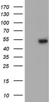 HEK293T cells were transfected with the pCMV6-ENTRY control (Left lane) or pCMV6-ENTRY ZNF365 (Right lane) cDNA for 48 hrs and lysed. Equivalent amounts of cell lysates (5 ug per lane) were separated by SDS-PAGE and immunoblotted with anti-ZNF365.