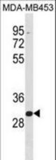 ZNF367 Antibody western blot of MDA-MB453 cell line lysates (35 ug/lane). The ZNF367 antibody detected the ZNF367 protein (arrow).