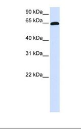 Placenta lysate. Antibody concentration: 1.0 ug/ml. Gel concentration: 12%.