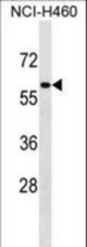 ZNF37A Antibody western blot of NCI-H460 cell line lysates (35 ug/lane). The ZNF37A antibody detected the ZNF37A protein (arrow).