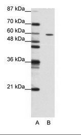 A: Marker, B: Jurkat Cell Lysate