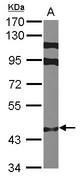 Sample (30 ug of whole cell lysate) A: MCF-7 7.5% SDS PAGE ZNF384 antibody diluted at 1:1000