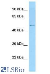 ZNF384 antibody Western Blot of Rat Small Intestine. Antibody dilution: 1 ug/ml.