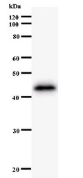 Western blot of immunized recombinant protein using ZNF384 antibody.