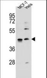 ZNF384 Antibody western blot of MCF-7,HeLa cell line lysates (35 ug/lane). The ZNF384 antibody detected the ZNF384 protein (arrow).