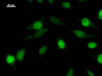 Immunostaining analysis in HeLa cells. HeLa cells were fixed with 4% paraformaldehyde and permeabilized with 0.1% Triton X-100 in PBS. The cells were immunostained with anti-ZNF384 mAb.