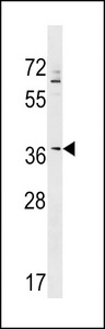ZNF385A Antibody western blot of K562 cell line lysates (35 ug/lane). The ZNF385A antibody detected the ZNF385A protein (arrow).