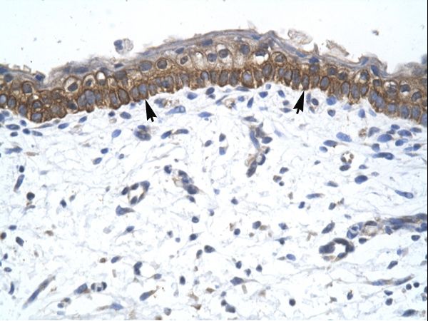 ZNF385A / ZNF385 antibody LS-C29762 was used in IHC to stain formalin-fixed, paraffin-embedded human skin.