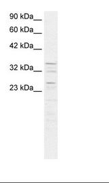 K562 Cell Lysate