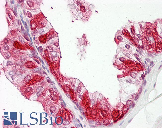 Anti-ZNF385A / ZNF385 antibody IHC of human prostate. Immunohistochemistry of formalin-fixed, paraffin-embedded tissue after heat-induced antigen retrieval. Antibody LS-B8062 dilution 5-7.5 ug/ml.