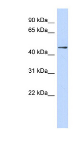 ZNF391 antibody LS-C101403 Western blot of Fetal Lung lysate.