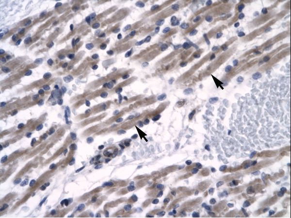 ZNF391 antibody LS-C29701 was used in IHC to stain formalin-fixed, paraffin-embedded human muscle.