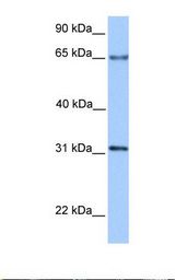 Transfected 293T cell lysate. Antibody concentration: 1.0 ug/ml. Gel concentration: 12%.