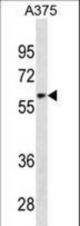 ZNF394 Antibody western blot of A375 cell line lysates (35 ug/lane). The ZNF394 antibody detected the ZNF394 protein (arrow).