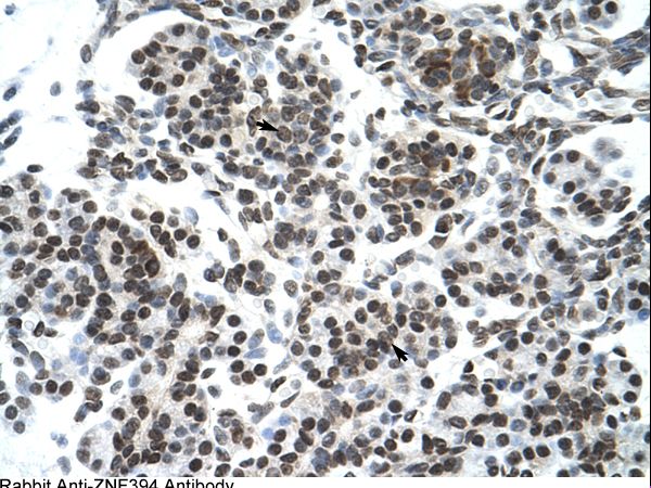 ZNF394 antibody LS-C30330 was used in IHC to stain formalin-fixed, paraffin-embedded human pancreas.