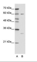 A: Marker, B: HepG2 Cell Lysate