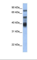 Transfected 293T cell lysate. Antibody concentration: 1.0 ug/ml. Gel concentration: 12%.