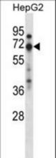 ZNF395 Antibody western blot of HepG2 cell line lysates (35 ug/lane). The ZNF395 antibody detected the ZNF395 protein (arrow).