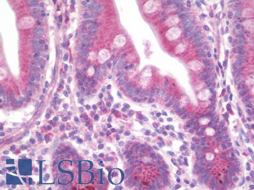 Anti-ZNF395 antibody IHC staining of human small intestine. Immunohistochemistry of formalin-fixed, paraffin-embedded tissue after heat-induced antigen retrieval. Antibody LS-B10560 dilution 1:100.