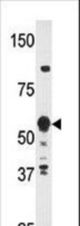 Western blot of anti-HDBP2(HDRF-2) Antibody in Y79 cell line lysates (35 ug/lane). HDBP2(arrow) was detected using the purified antibody.