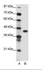A: Marker, B: Jurkat Cell Lysate