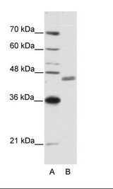 A: Marker, B: Jurkat Cell Lysate