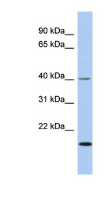 ZNF396 antibody LS-C109970 Western blot of Fetal Small Intestine lysate.