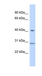 ZNF396 antibody LS-C110449 Western blot of Fetal Muscle lysate.