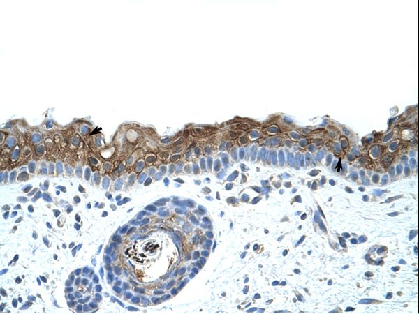 ZNF397 antibody LS-C30680 was used in IHC to stain formalin-fixed, paraffin-embedded human skin.