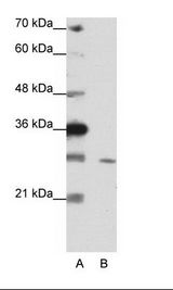 A: Marker, B: HepG2 Cell Lysate