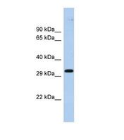 Western blot of Human Fetal Brain. ZNF397 antibody dilution 1.0 ug/ml.